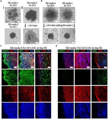 Brain organoids engineered to give rise to glia and neural networks after 90 days in culture exhibit human-specific proteoforms